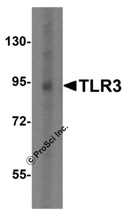 Western blot analysis of TLR3 in EL4 cell lysate with TLR3 antibody at 0.5 μg/mL.