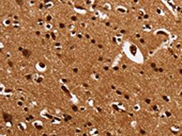 The image is immunohistochemistry of paraffin-embedded Human brain tissue using CSB-PA909603(UPK3B Antibody) at dilution 1/25. (Original magnification: ×200)
