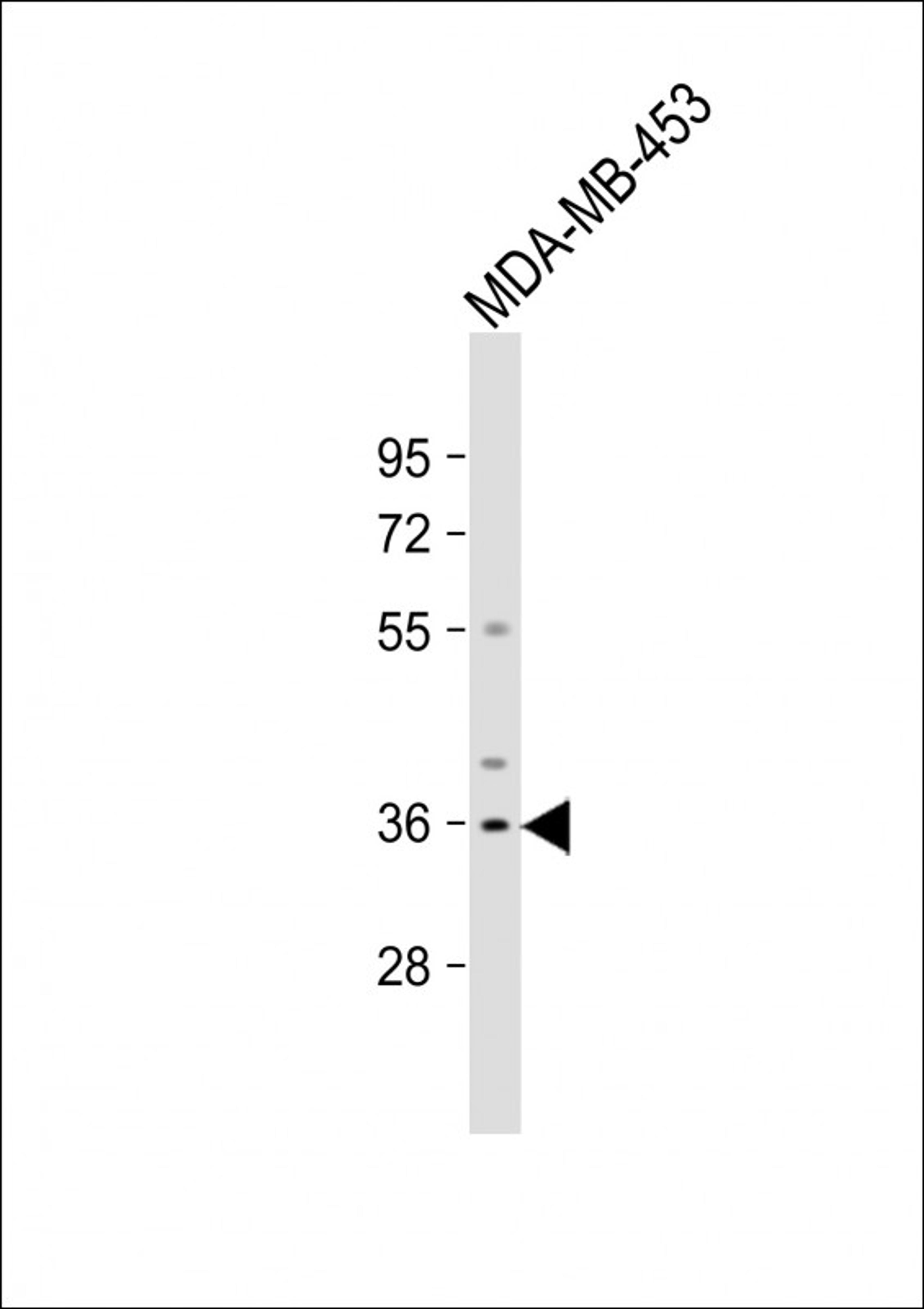 Western Blot at 1:1000 dilution + MDA-MB-453 whole cell lysate Lysates/proteins at 20 ug per lane.