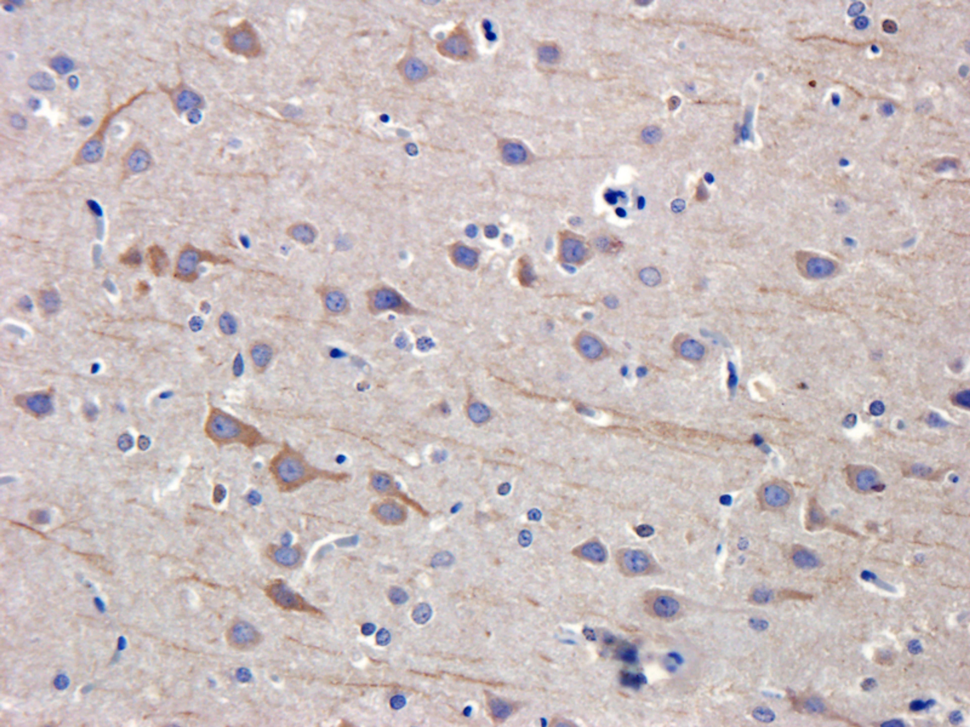 Immunohistochemical staining of paraffin embedded rat brain tissue using anti-SDF1 (primary antibody at 1:100)