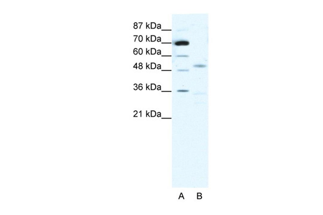 Antibody used in WB on Human MCF-7 at 1 ug/ml.