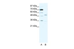 Antibody used in WB on Human MCF-7 at 1 ug/ml.