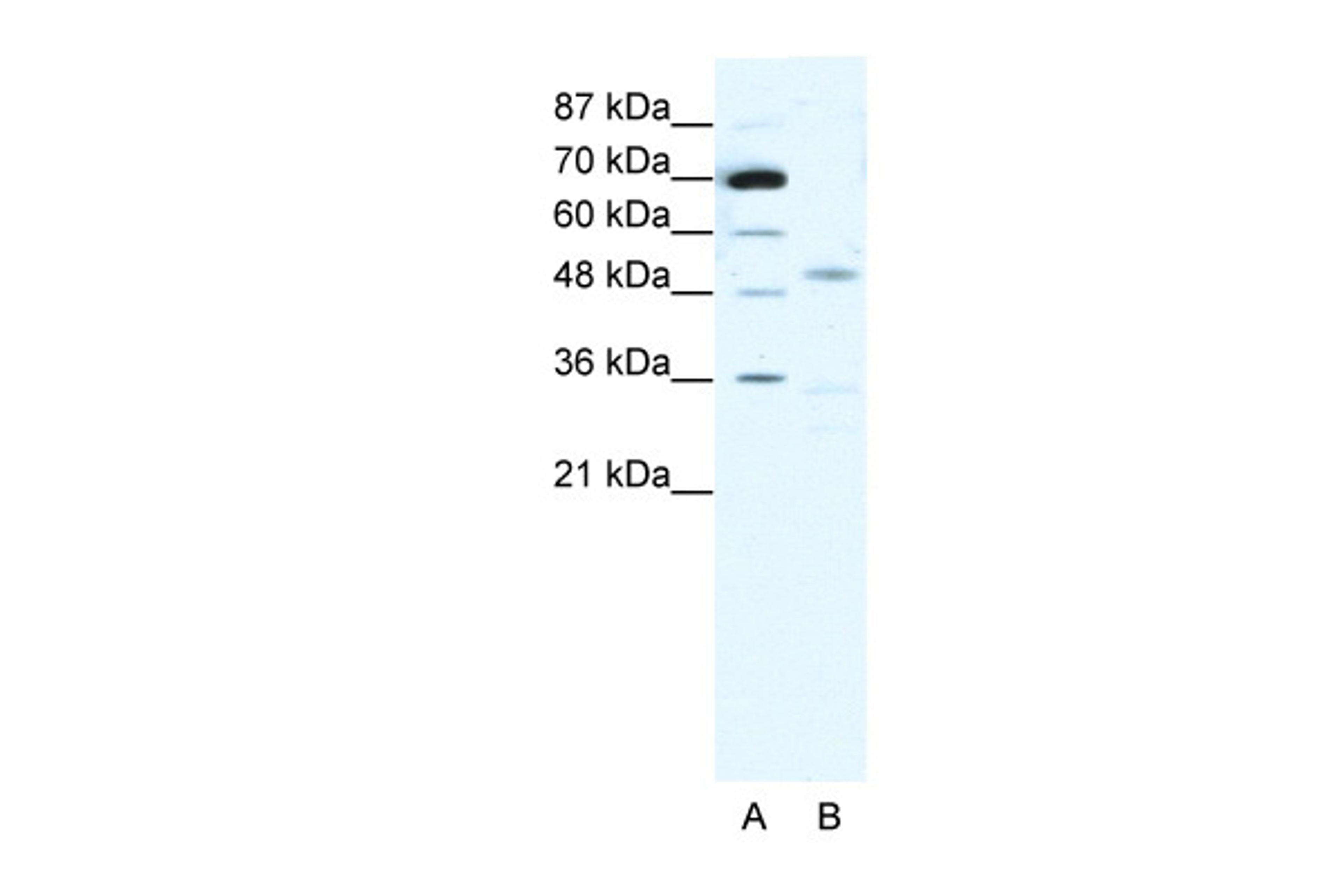 Antibody used in WB on Human MCF-7 at 1 ug/ml.