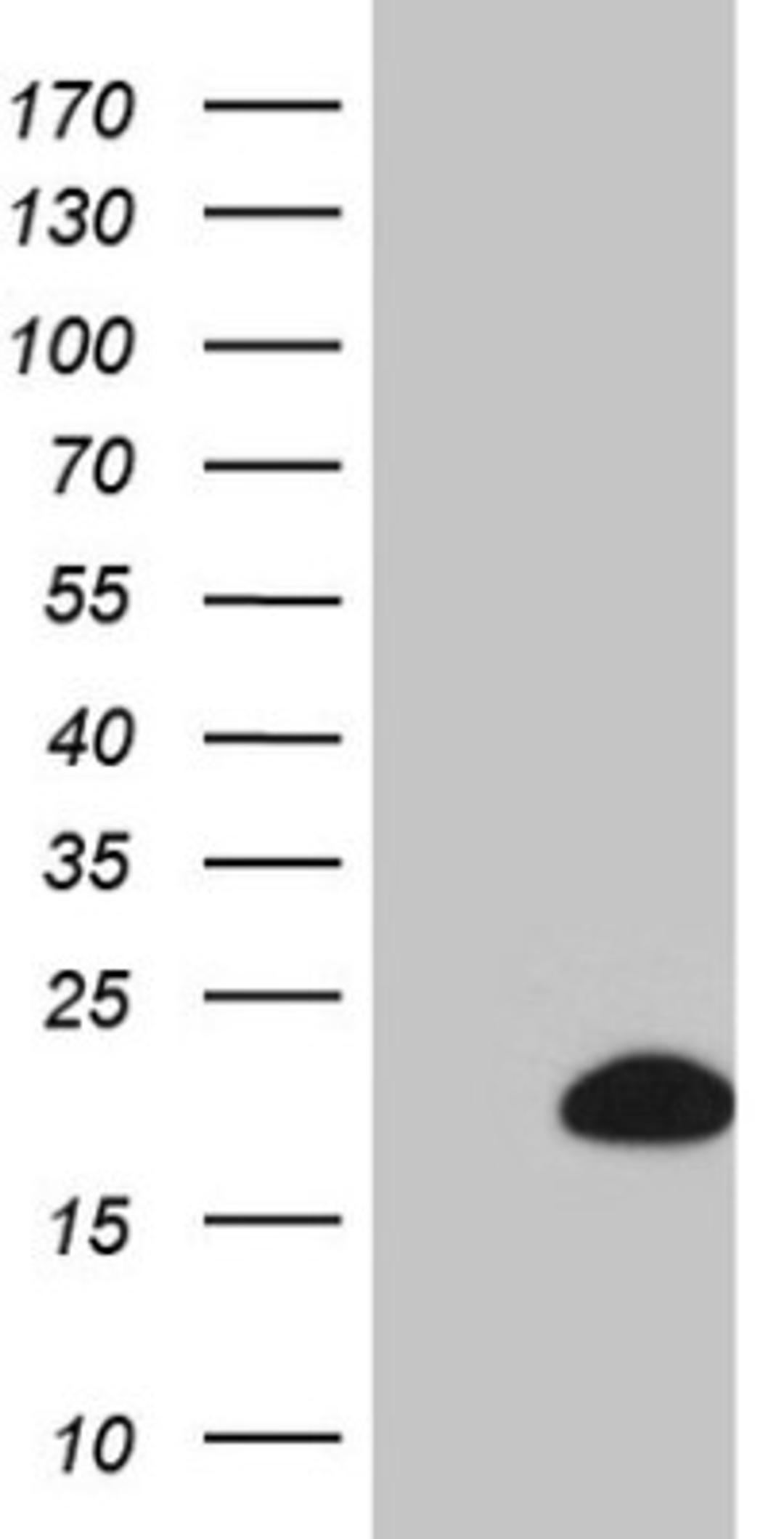 Western Blot: BTG1 Antibody (4C10) [NBP2-46587] - Analysis of HEK293T cells were transfected with the pCMV6-ENTRY control (Left lane) or pCMV6-ENTRY BTG 1.