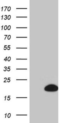 Western Blot: BTG1 Antibody (4C10) [NBP2-46587] - Analysis of HEK293T cells were transfected with the pCMV6-ENTRY control (Left lane) or pCMV6-ENTRY BTG 1.