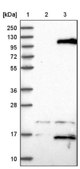 Western Blot: TTC16 Antibody [NBP1-83522] - Lane 1: Marker [kDa] 250, 130, 95, 72, 55, 36, 28, 17, 10<br/>Lane 2: Negative control (vector only transfected HEK293T lysate)<br/>Lane 3: Over-expression lysate (Co-expressed with a C-terminal myc-DDK tag (~3.1 kDa) in mammalian HEK293T cells, LY408103)