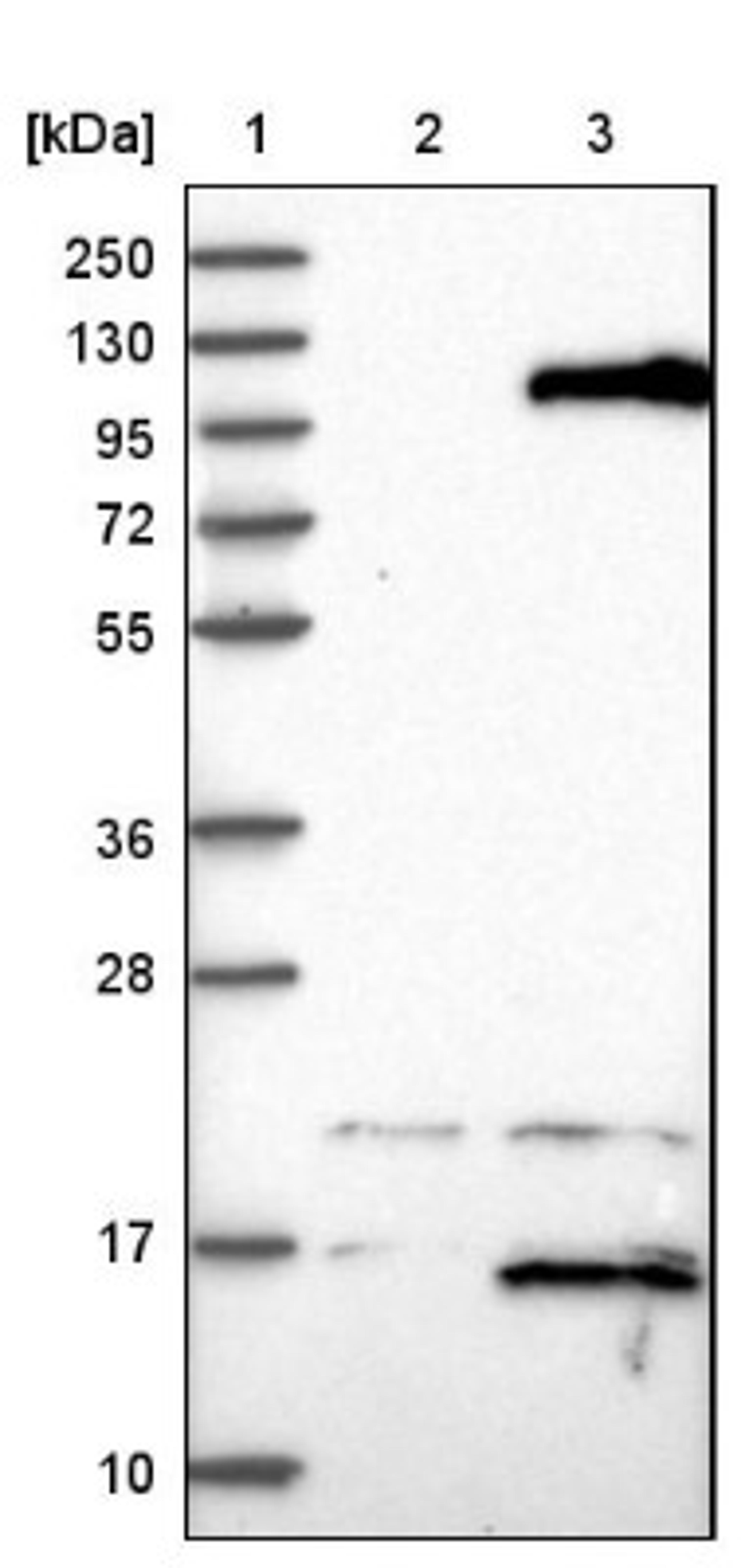 Western Blot: TTC16 Antibody [NBP1-83522] - Lane 1: Marker [kDa] 250, 130, 95, 72, 55, 36, 28, 17, 10<br/>Lane 2: Negative control (vector only transfected HEK293T lysate)<br/>Lane 3: Over-expression lysate (Co-expressed with a C-terminal myc-DDK tag (~3.1 kDa) in mammalian HEK293T cells, LY408103)