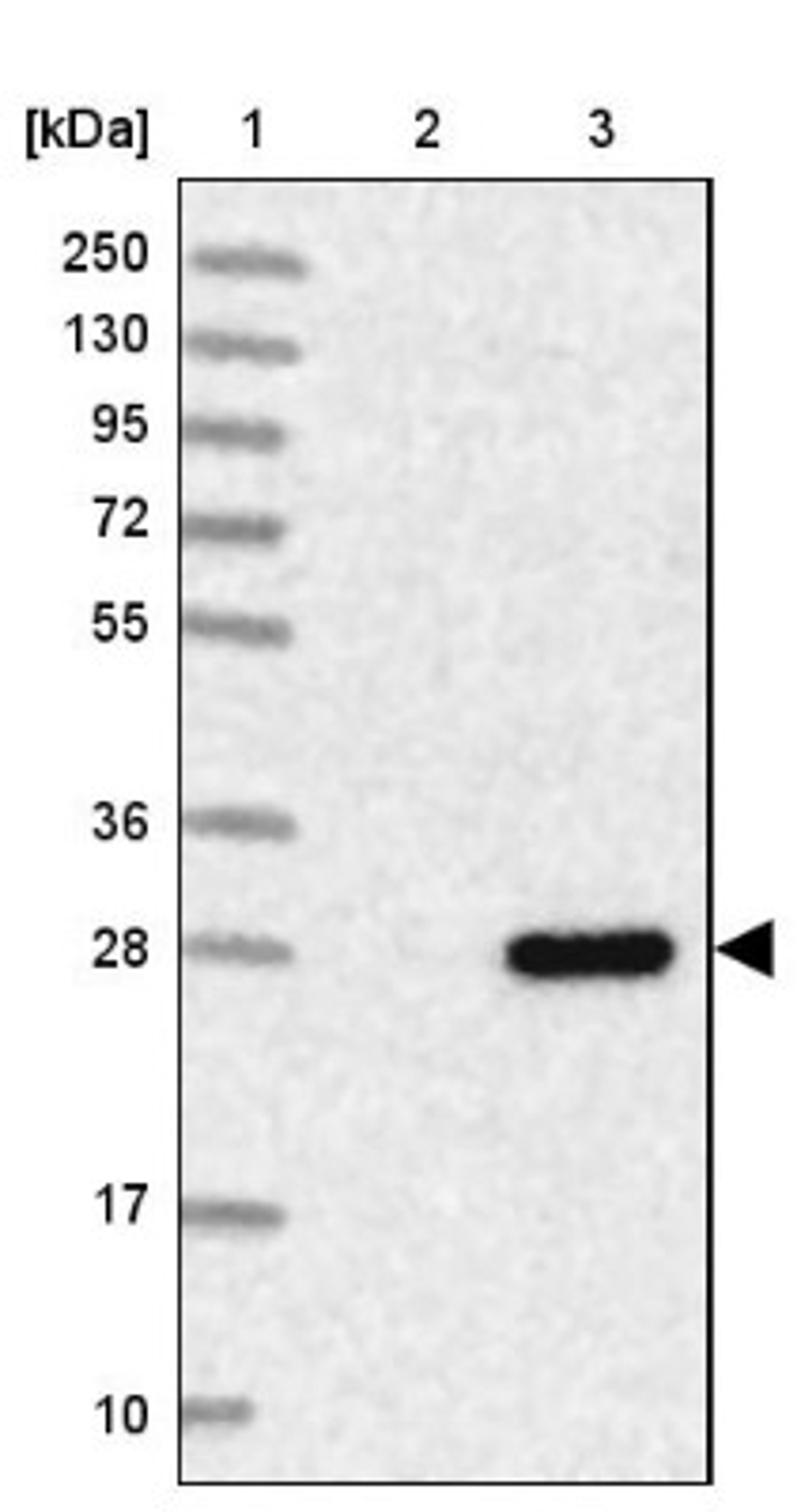 Western Blot: FLJ11184 Antibody [NBP1-87907] - Lane 1: Marker [kDa] 250, 130, 95, 72, 55, 36, 28, 17, 10<br/>Lane 2: Human cell line RT-4<br/>Lane 3: Human cell line U-251MG sp