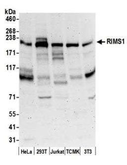 Detection of human and mouse RIMS1 by western blot.