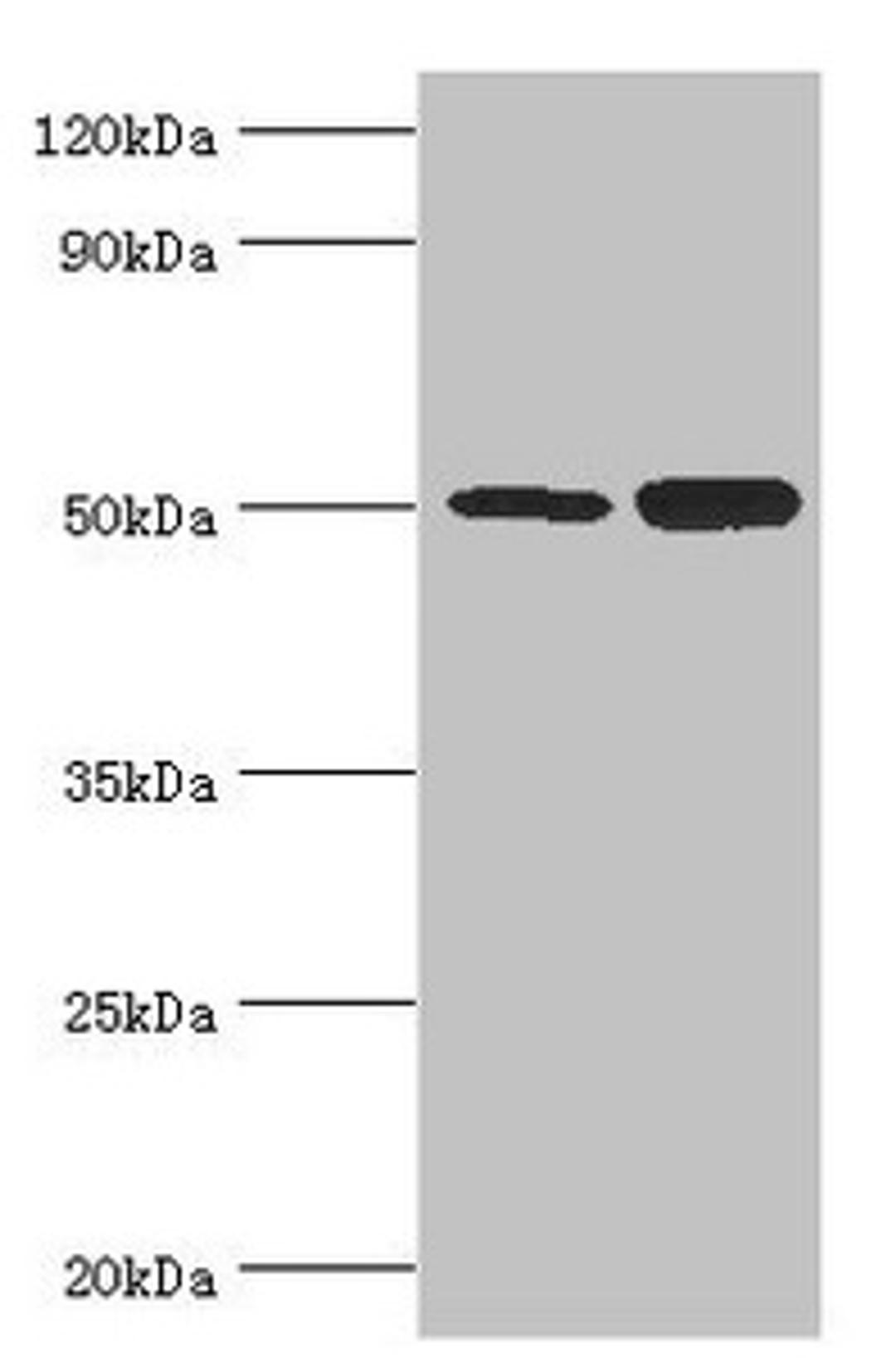 Western blot. All lanes: Polycomb protein EED antibody at 4ug/ml. Lane 1: Hela whole cell lysate. Lane 2: K562 whole cell lysate. Secondary. Goat polyclonal to rabbit IgG at 1/10000 dilution. Predicted band size: 51, 54, 46 kDa. Observed band size: 51 kDa.