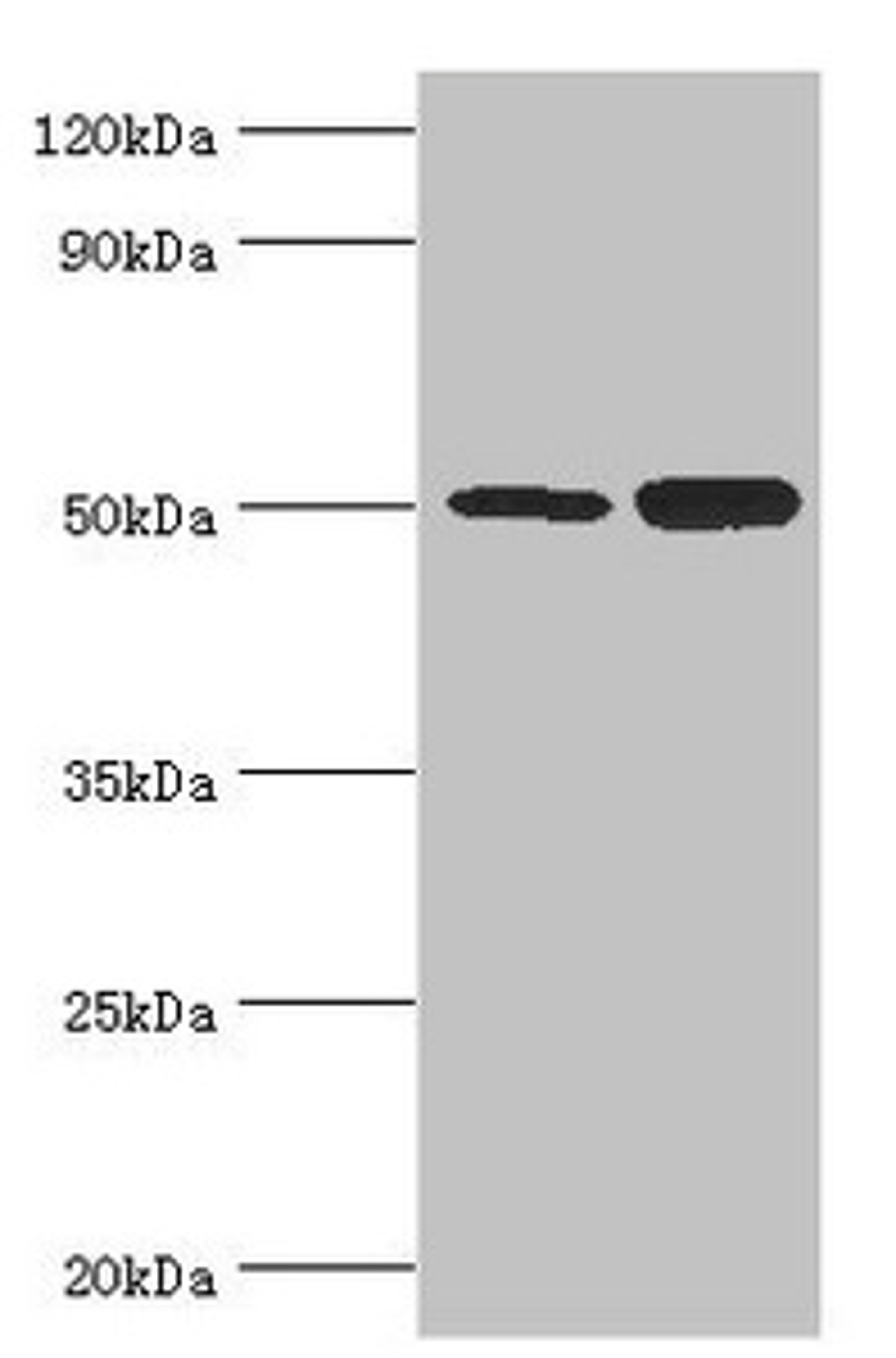 Western blot. All lanes: Polycomb protein EED antibody at 4ug/ml. Lane 1: Hela whole cell lysate. Lane 2: K562 whole cell lysate. Secondary. Goat polyclonal to rabbit IgG at 1/10000 dilution. Predicted band size: 51, 54, 46 kDa. Observed band size: 51 kDa.