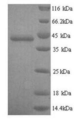 (Tris-Glycine gel) Discontinuous SDS-PAGE (reduced) with 5% enrichment gel and 15% separation gel.