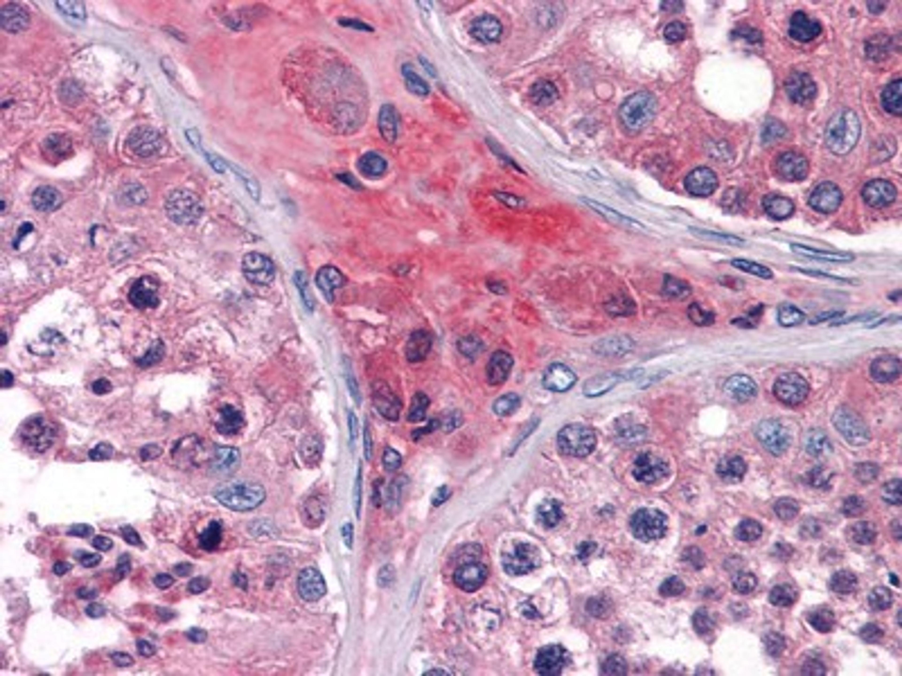 Immunohistochemistry-Paraffin: APOO Antibody (2F1) [NBP1-28870] - Immunohistochemical analysis of paraffin-embedded human Testis tissues using ApoO mouse mAb