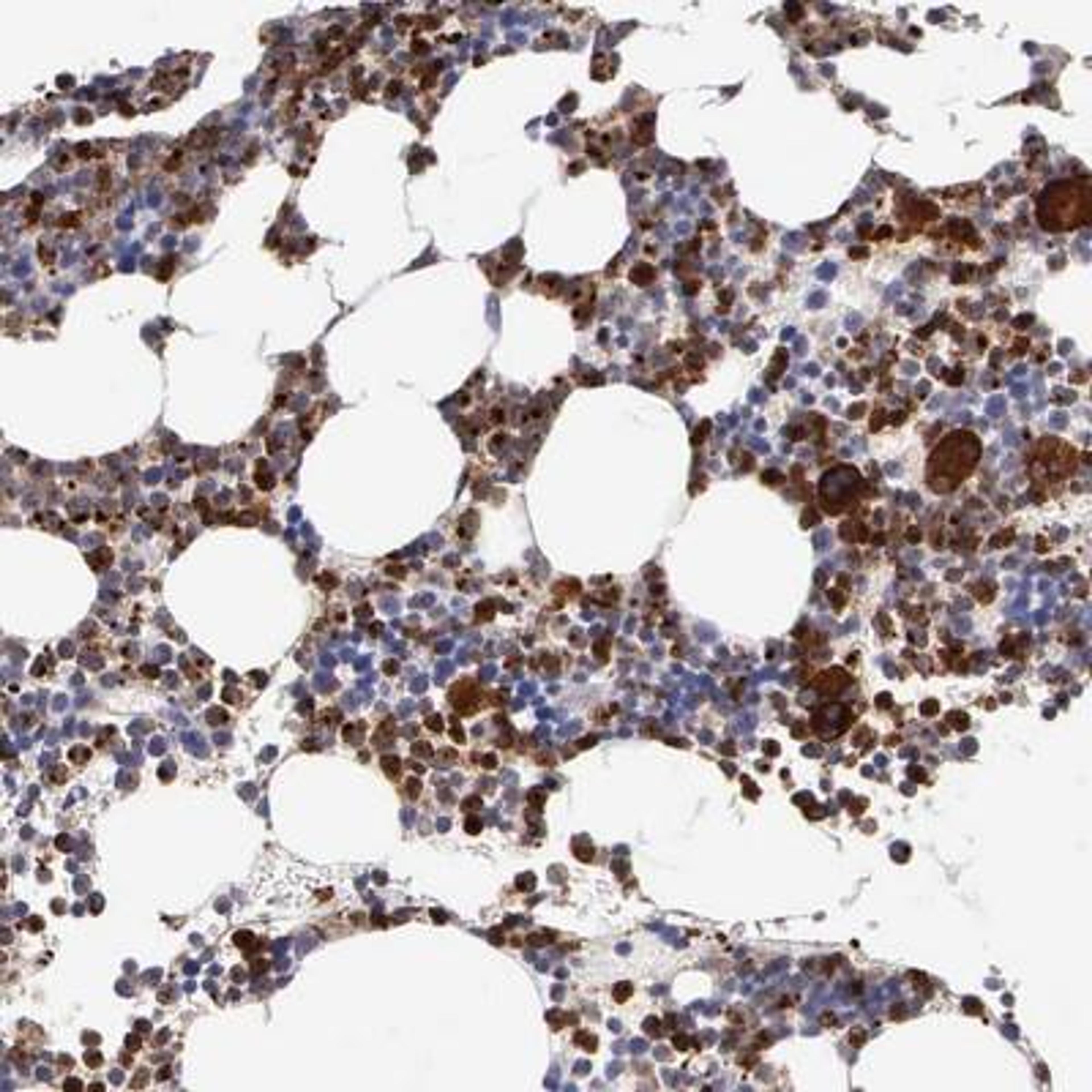 Immunohistochemistry: SRGN Antibody [NBP1-80886] - Staining of human bone marrow shows strong cytoplasmic positivity in subsets of bone marrow poietic cells.