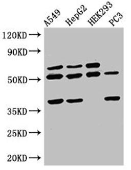 Western Blot. Positive WB detected in: A549 whole cell lysate, HepG2 whole cell lysate, HEK293 whole cell lysate, PC-3 whole cell lysate. All lanes: TAF1A antibody at 2.5µg/ml. Secondary. Goat polyclonal to rabbit IgG at 1/50000 dilution. Predicted band size: 53, 40 kDa. Observed band size: 53, 40 kDa