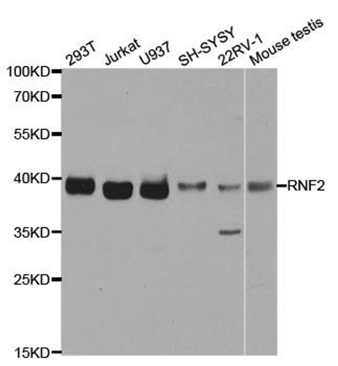 Western blot analysis of extracts of various cell lines using RNF2 antibody