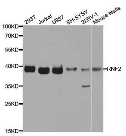 Western blot analysis of extracts of various cell lines using RNF2 antibody