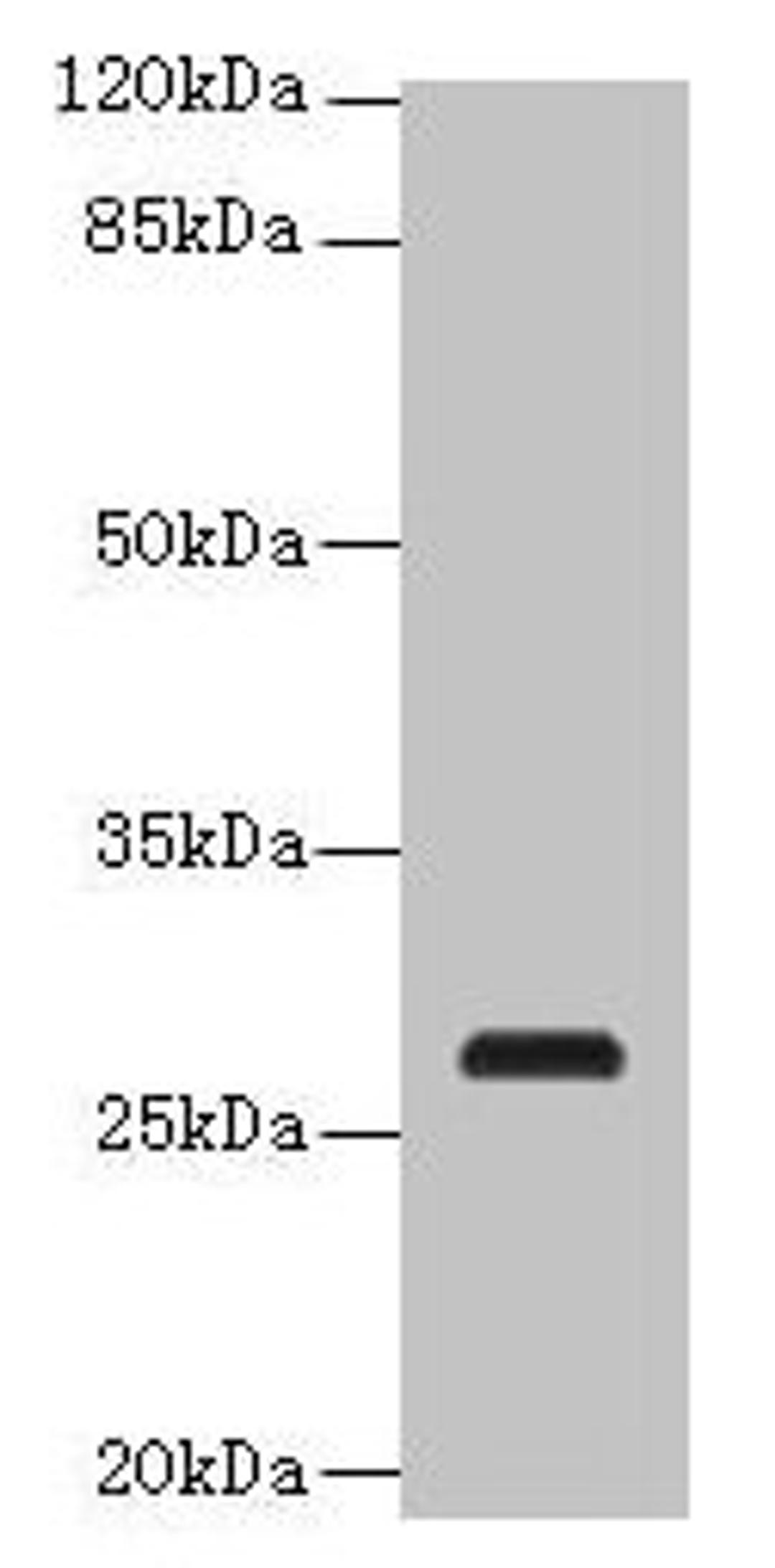 Western blot. All lanes: C17orf64 antibody at 4µg/ml + Mouse gonadal tissue. Secondary. Goat polyclonal to rabbit IgG at 1/10000 dilution. Predicted band size: 28 kDa. Observed band size: 28 kDa
