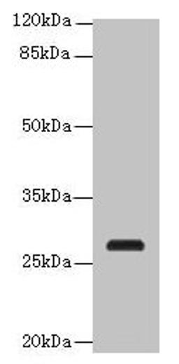 Western blot. All lanes: C17orf64 antibody at 4µg/ml + Mouse gonadal tissue. Secondary. Goat polyclonal to rabbit IgG at 1/10000 dilution. Predicted band size: 28 kDa. Observed band size: 28 kDa