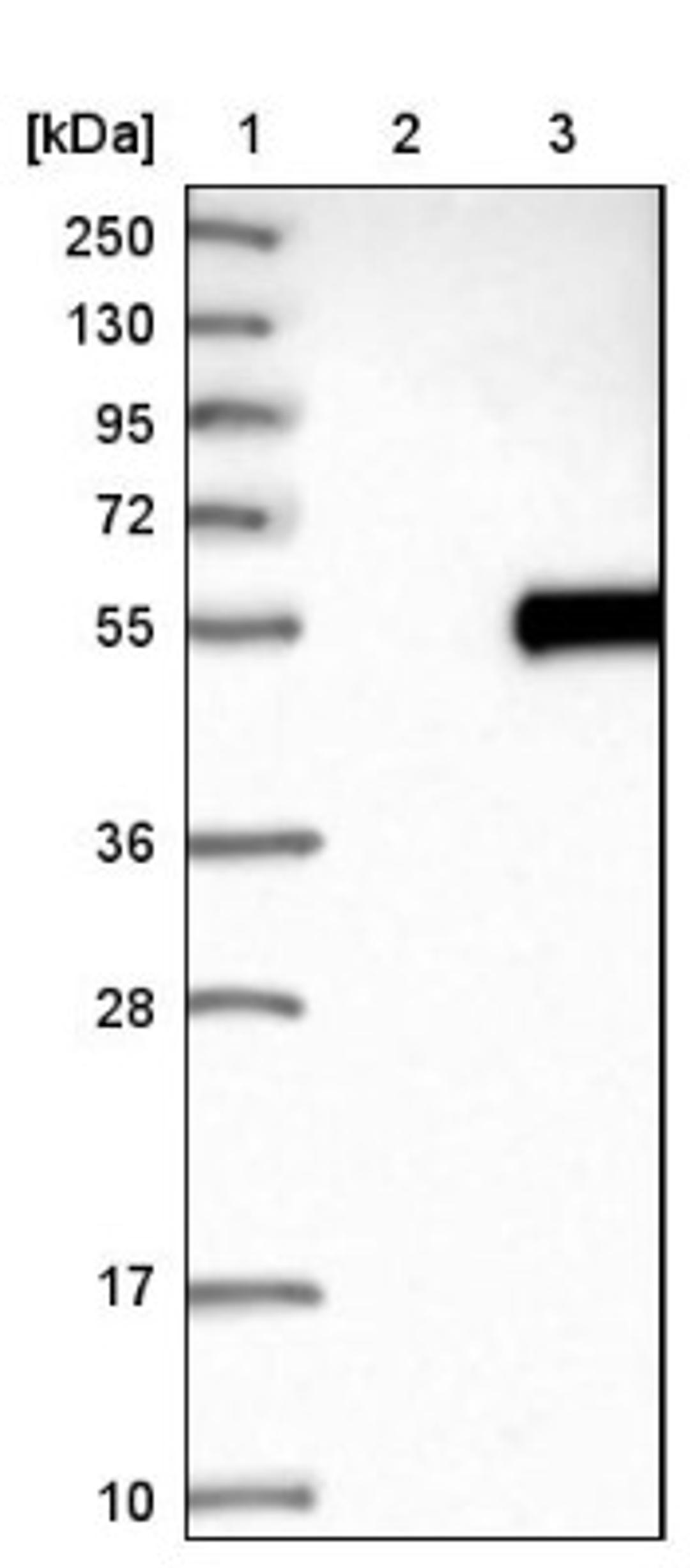 Western Blot: TIM4 Antibody [NBP1-87569] - Lane 1: Marker [kDa] 250, 130, 95, 72, 55, 36, 28, 17, 10<br/>Lane 2: Negative control (vector only transfected HEK293T lysate)<br/>Lane 3: Over-expression lysate (Co-expressed with a C-terminal myc-DDK tag (~3.1 kDa) in mammalian HEK293T cells, LY408645)