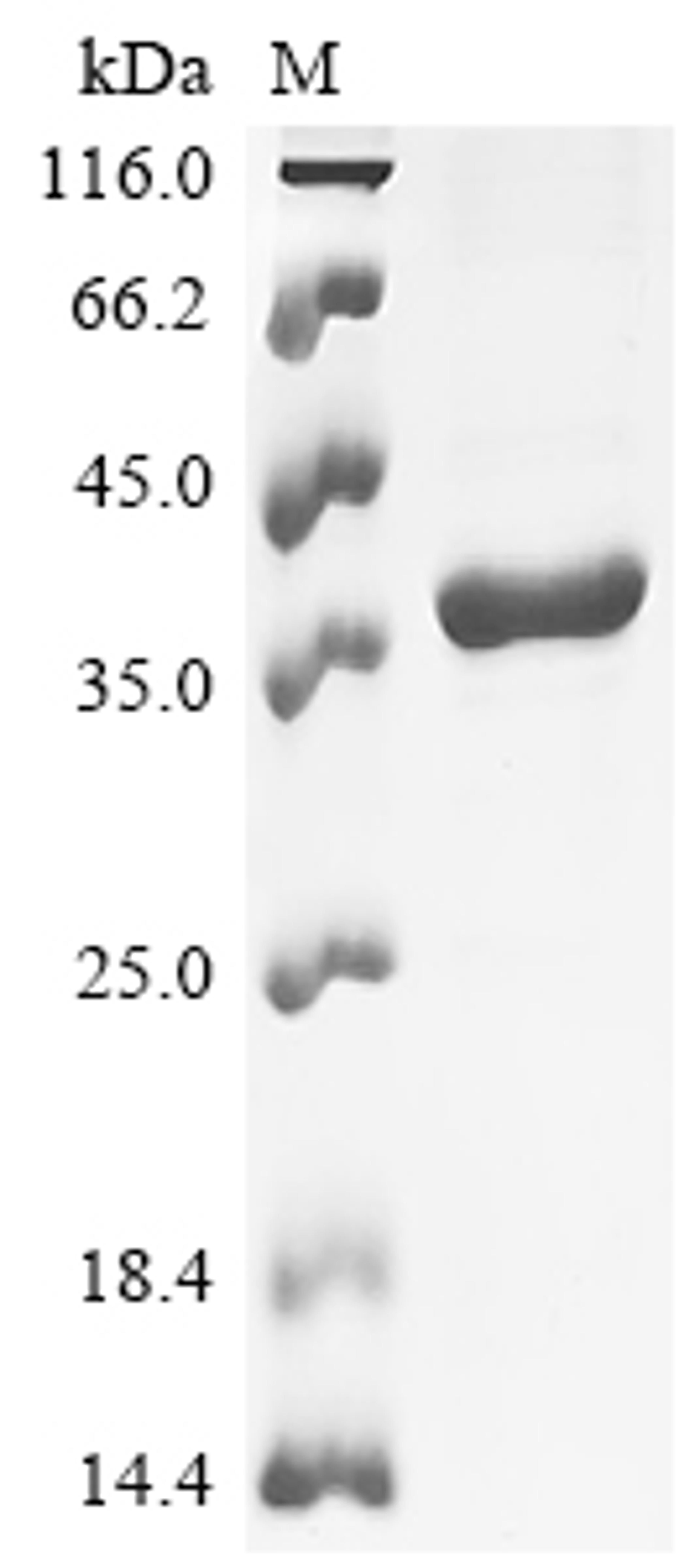 (Tris-Glycine gel) Discontinuous SDS-PAGE (reduced) with 5% enrichment gel and 15% separation gel.