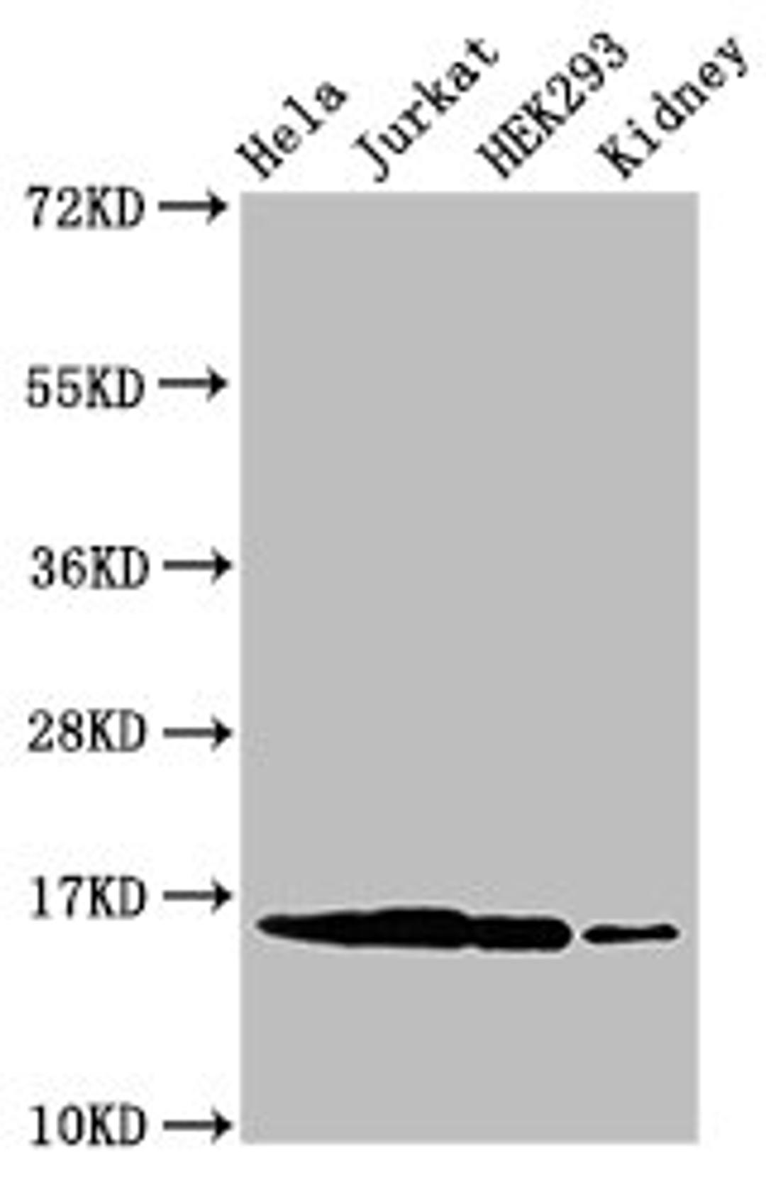Western Blot. Positive WB detected in: Hela cell acid extracts, Jurkat cell acid extracts, HEK293 cell acid extracts, Mouse kidney tissue. All lanes: HIST1H3A antibody at 0.4µg/ml. Secondary. Goat polyclonal to rabbit IgG at 1/50000 dilution. Predicted band size: 16 kDa. Observed band size: 16 kDa