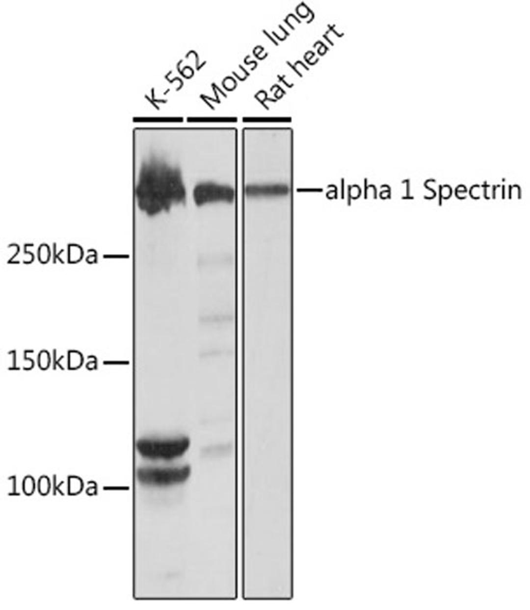 Western blot - alpha 1 Spectrin Rabbit mAb (A9597)