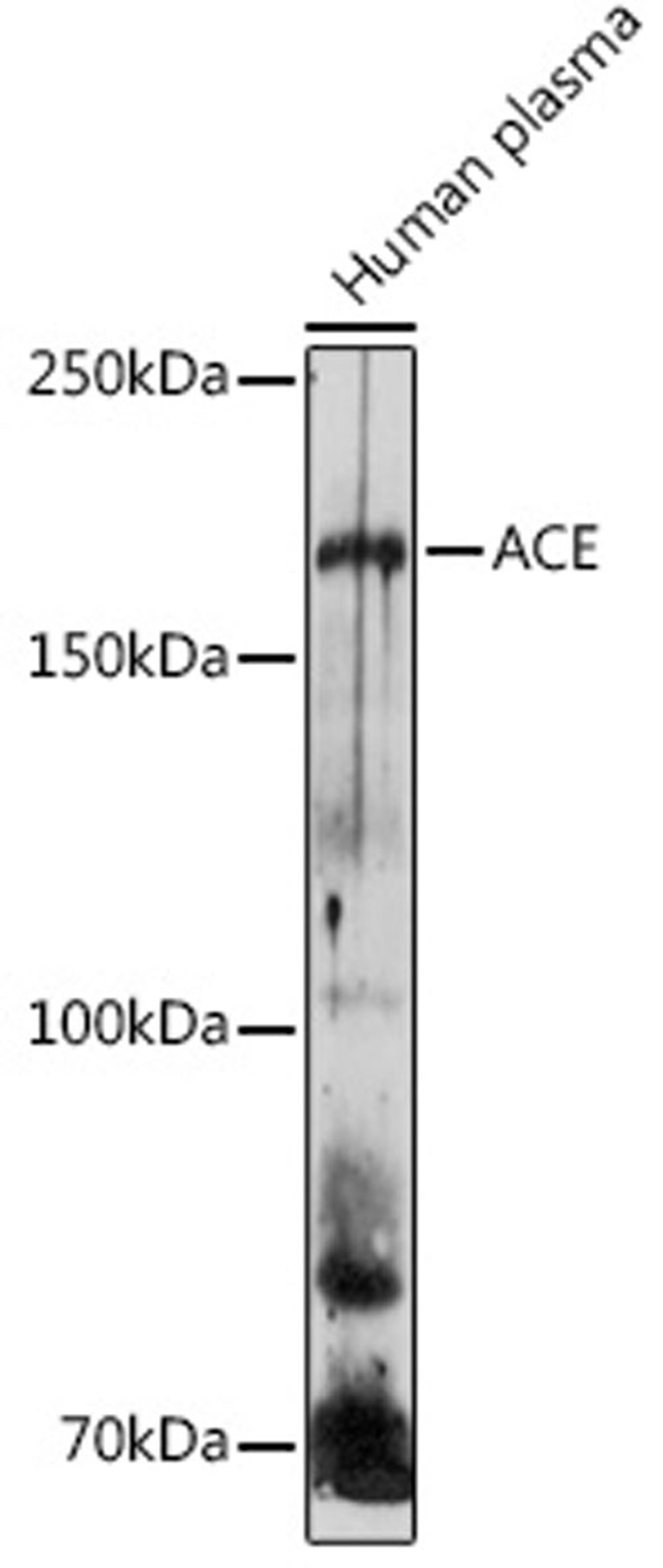 Western blot - ACE antibody (A2805)