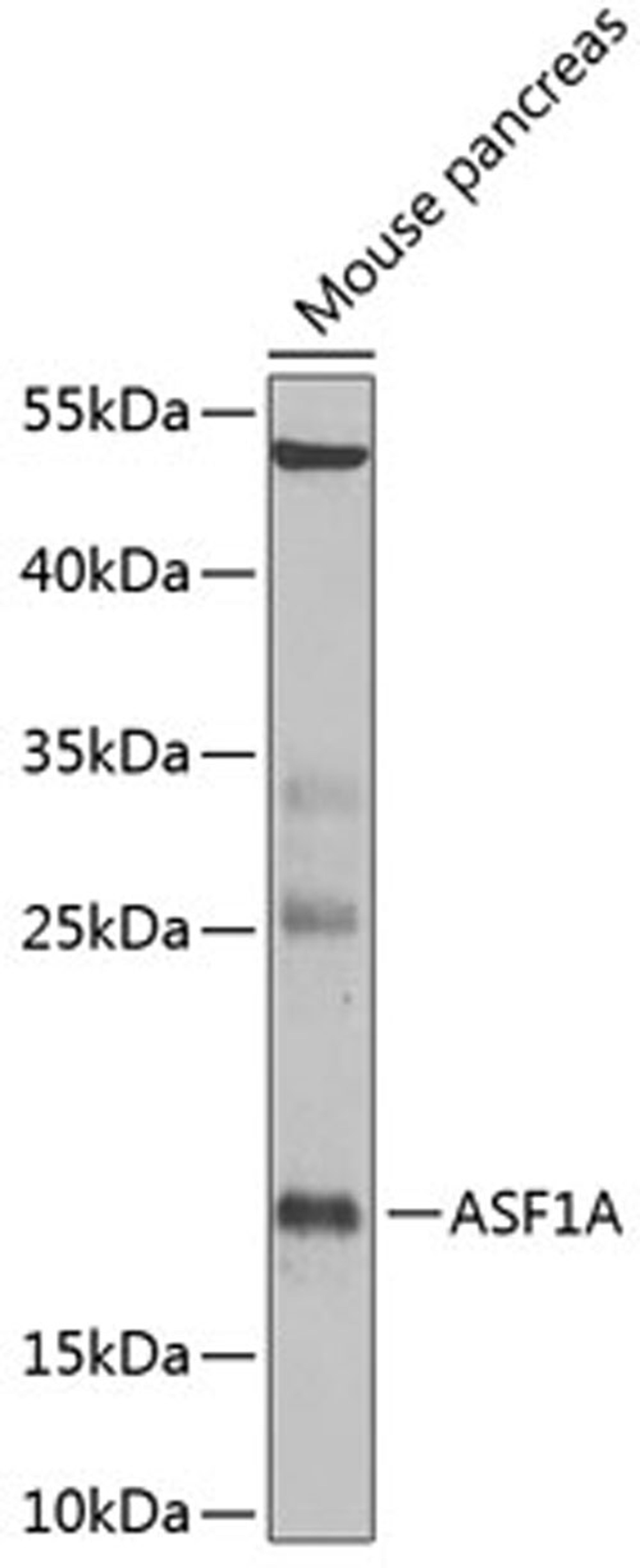 Western blot - ASF1A Antibody (A6528)