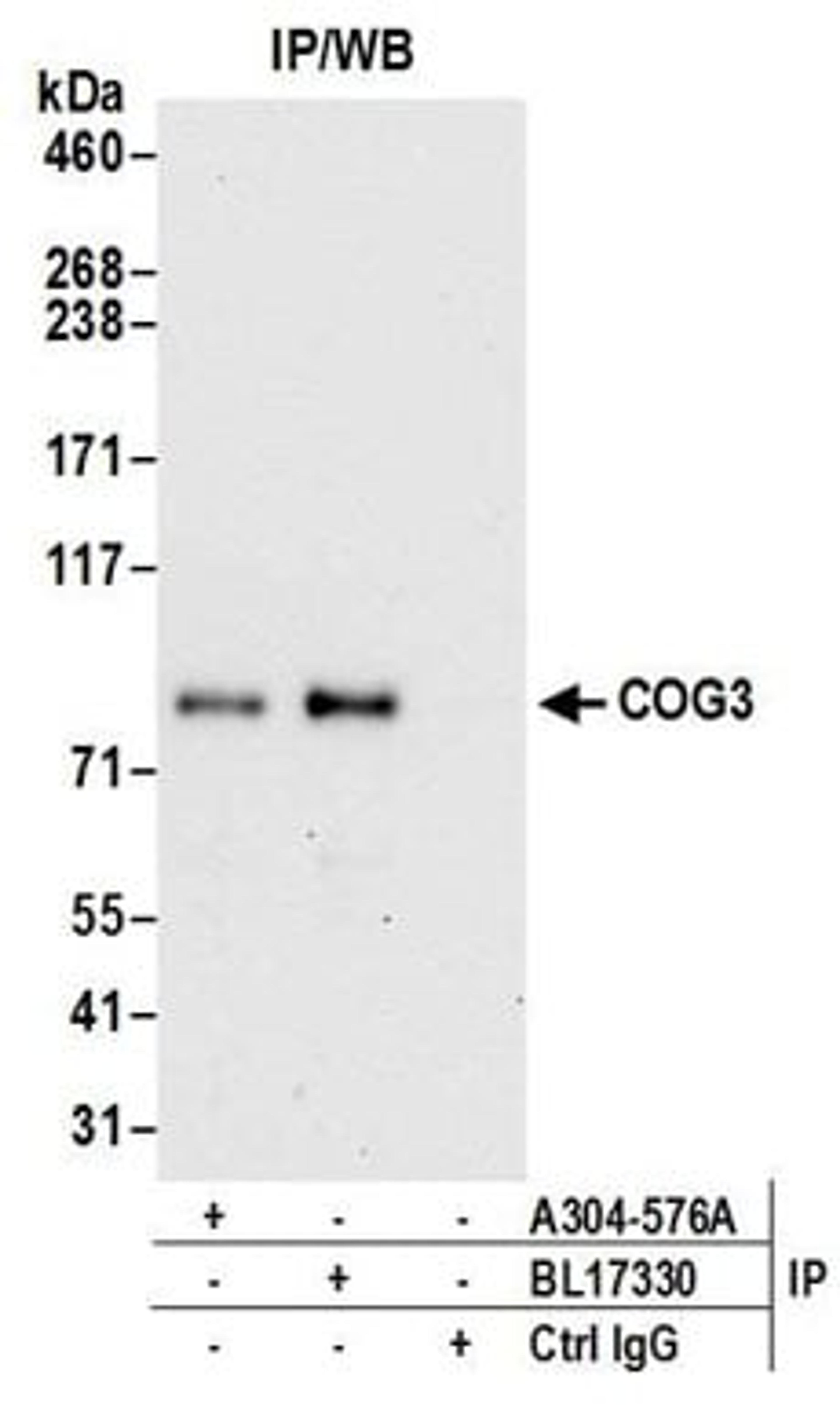 Detection of human COG3 by western blot of immunoprecipitates.