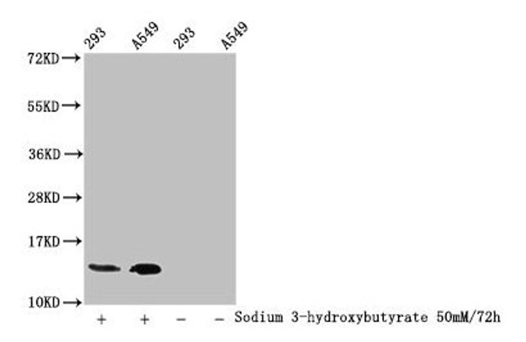 Western Blot. Detected samples: 293 whole cell lysate, A549 whole cell lysate; Untreated (-) or treated (+) with 50mM Sodium 3-hydroxybutyrate for 72h. All lanes: HIST1H2BC antibody at 1:100. Secondary. Goat polyclonal to rabbit IgG at 1/50000 dilution. Predicted band size: 14 kDa. Observed band size: 14 kDa