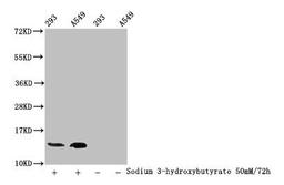 Western Blot. Detected samples: 293 whole cell lysate, A549 whole cell lysate; Untreated (-) or treated (+) with 50mM Sodium 3-hydroxybutyrate for 72h. All lanes: HIST1H2BC antibody at 1:100. Secondary. Goat polyclonal to rabbit IgG at 1/50000 dilution. Predicted band size: 14 kDa. Observed band size: 14 kDa