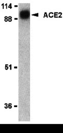 Western blot analysis of ACE2 in human kidney lysate with ACE2 antibody at 1 &#956;g/mL. 