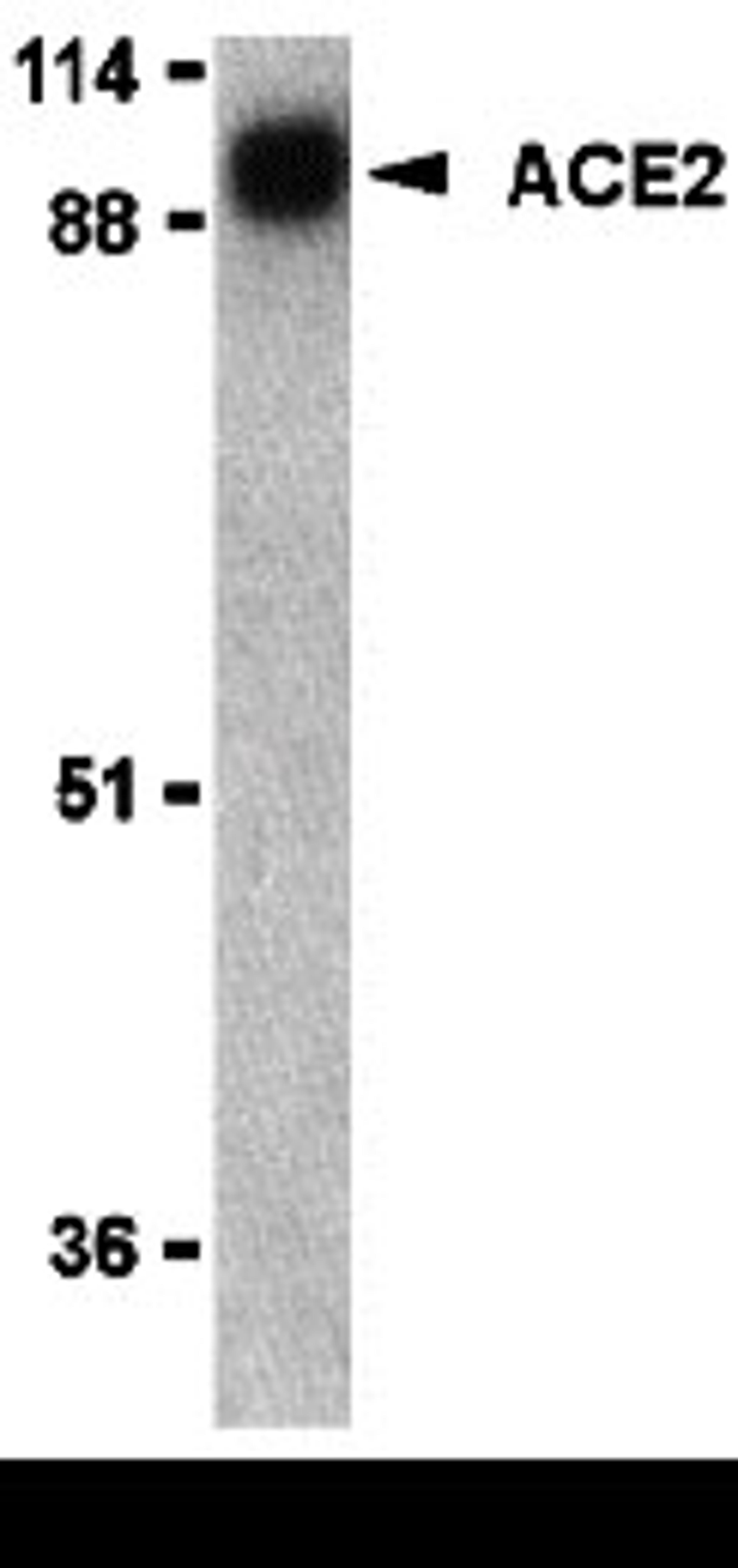 Western blot analysis of ACE2 in human kidney lysate with ACE2 antibody at 1 &#956;g/mL. 