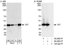 Detection of human XLF by western blot and immunoprecipitation.