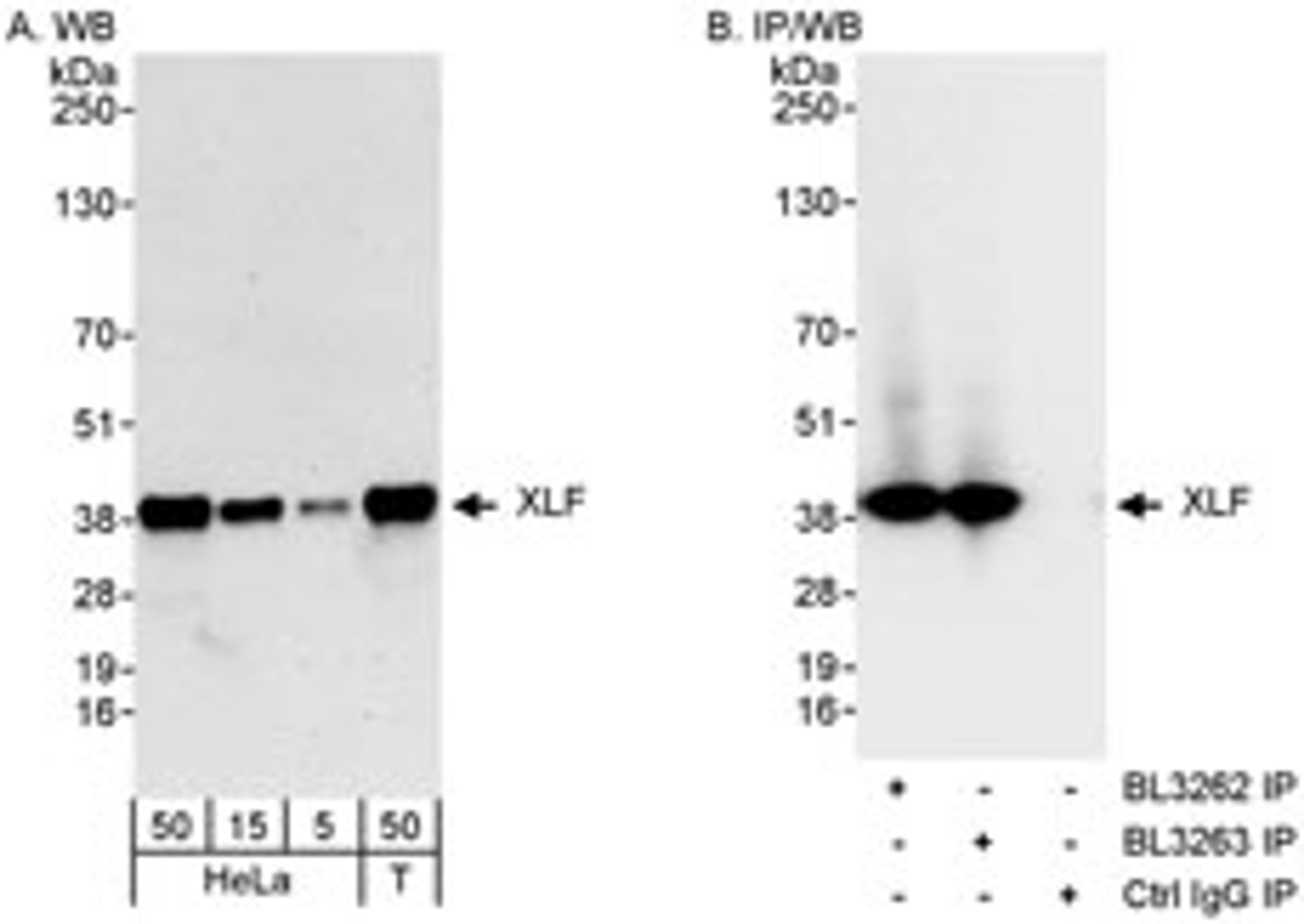 Detection of human XLF by western blot and immunoprecipitation.