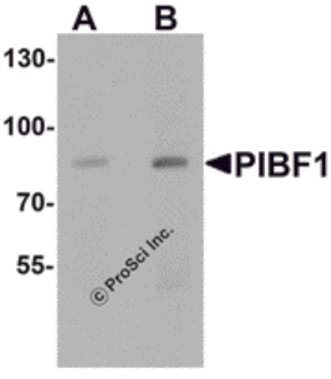 Western blot analysis of PIBF1 in human placenta tissue lysate with PIBF1 antibody at (A) 1 and (B) 2 μg/mL