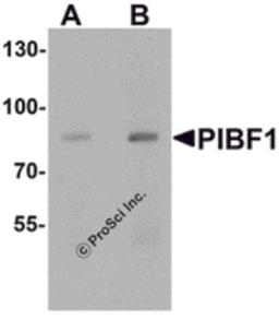Western blot analysis of PIBF1 in human placenta tissue lysate with PIBF1 antibody at (A) 1 and (B) 2 μg/mL