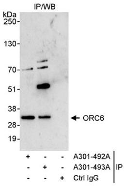 Detection of human ORC6 by western blot of immunoprecipitates.