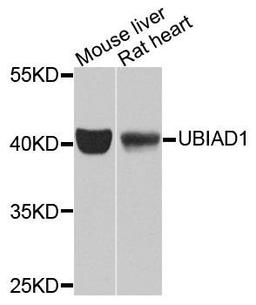 Western blot analysis of extracts of various tissues using UBIAD1 antibody