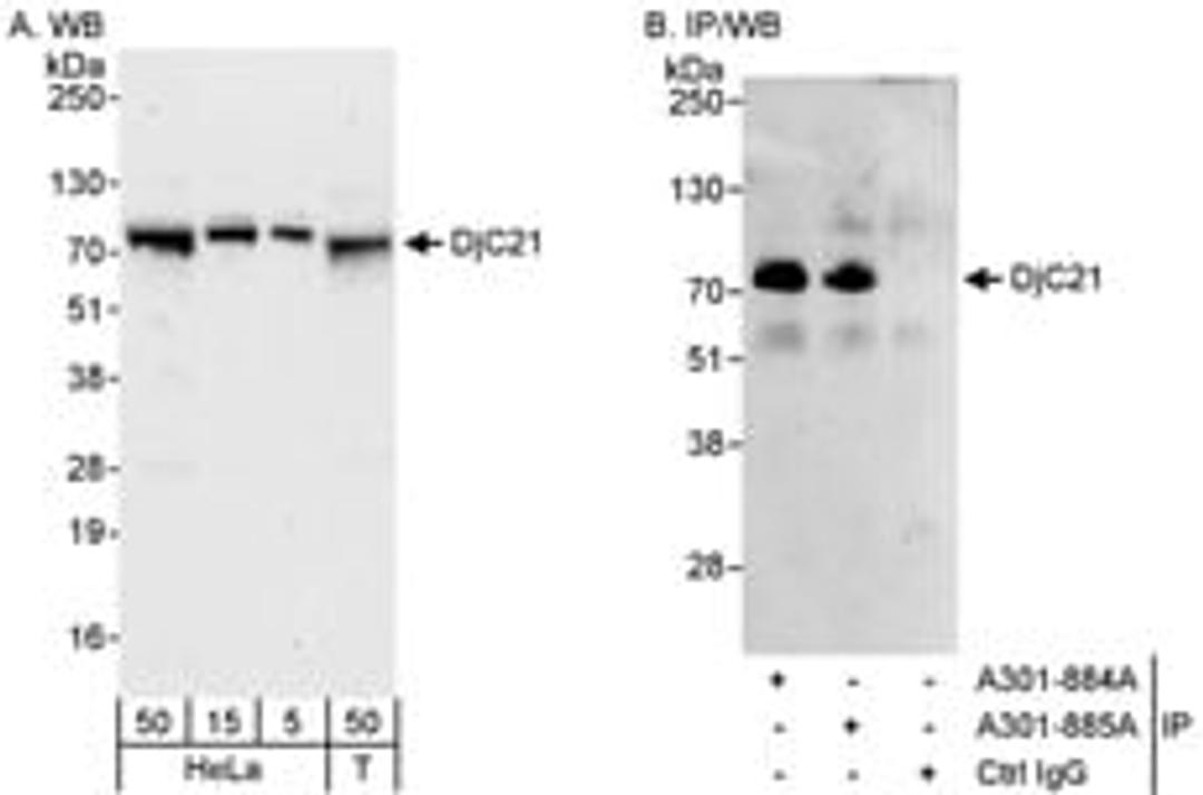 Detection of human DjC21 by western blot and immunoprecipitation.