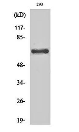 Western blot analysis of 293 cell lysates using Cleaved-ITI-H2 (D702) antibody