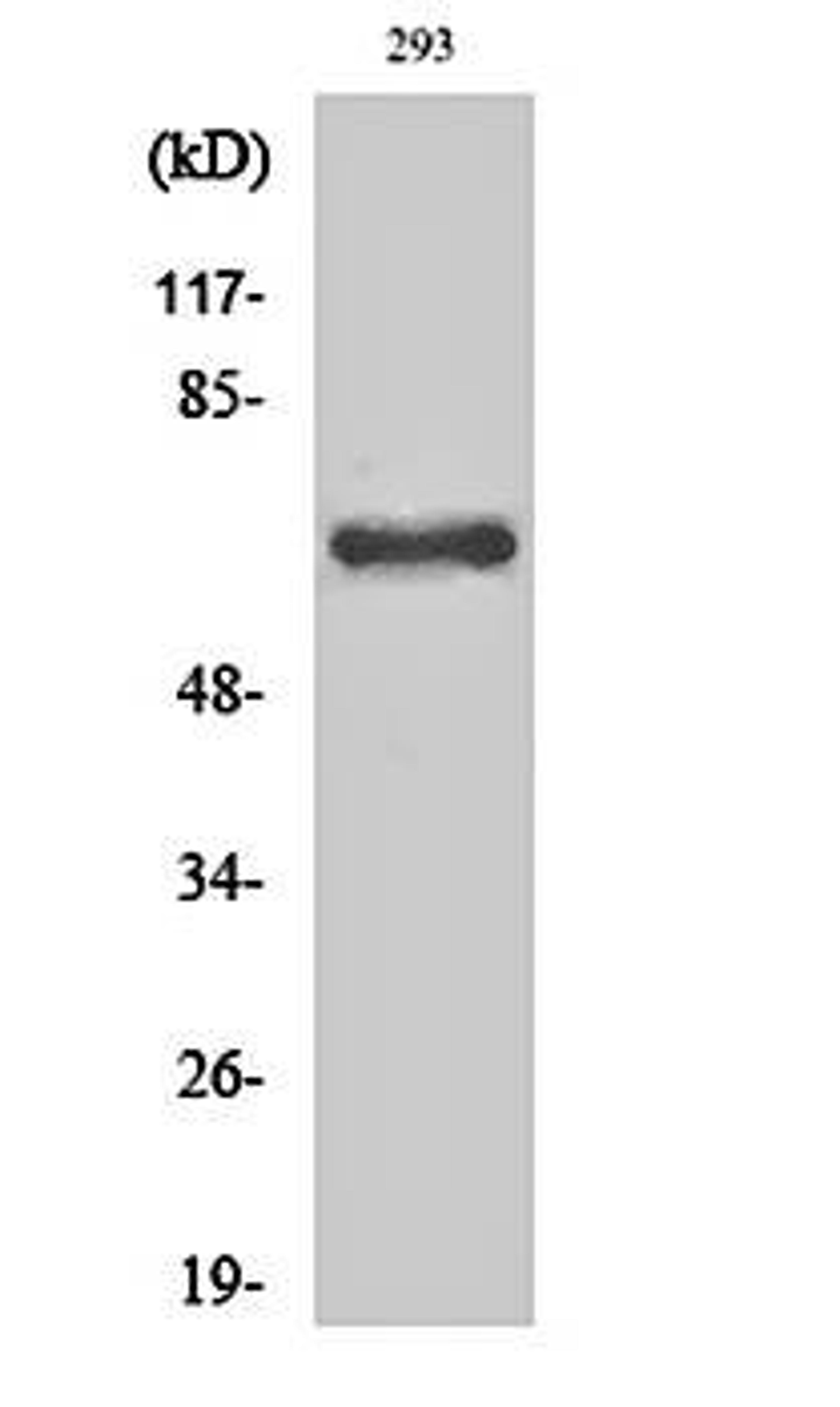 Western blot analysis of 293 cell lysates using Cleaved-ITI-H2 (D702) antibody