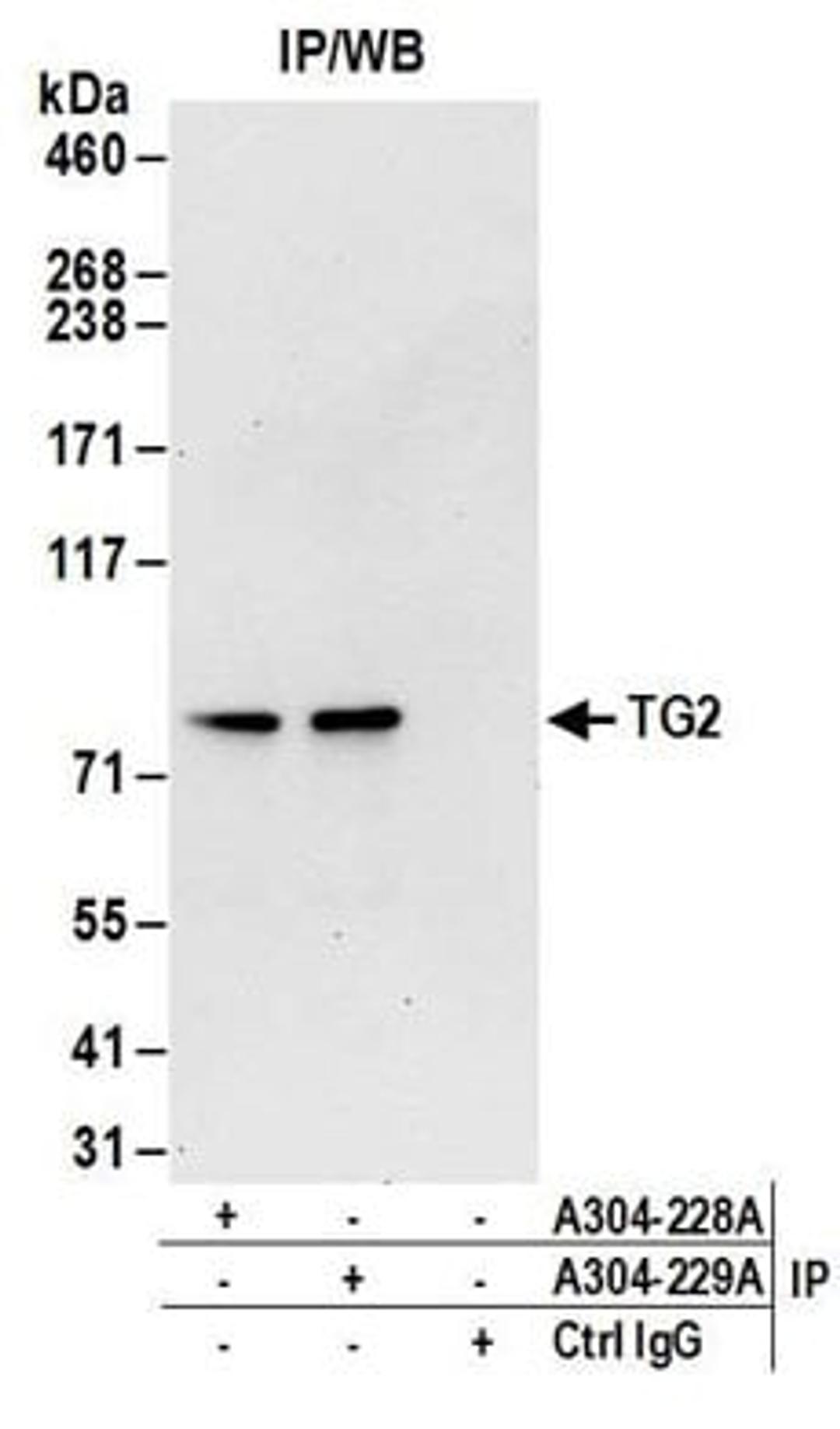 Detection of human TG2 by western blot of immunoprecipitates.