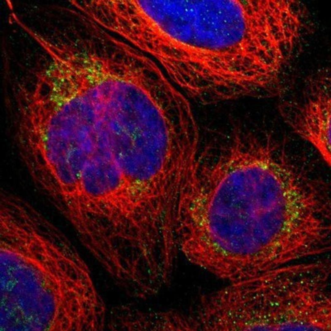 Immunocytochemistry/Immunofluorescence: PARL Antibody [NBP1-80878] - Staining of human cell line A-431 shows positivity in mitochondria.