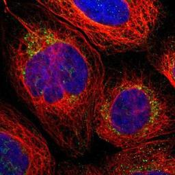 Immunocytochemistry/Immunofluorescence: PARL Antibody [NBP1-80878] - Staining of human cell line A-431 shows positivity in mitochondria.