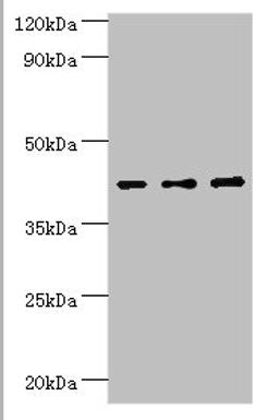 Western blot. All lanes: Leukocyte elastase inhibitor antibody at 4ug/ml. Lane 1: MCF-7 whole cell lysate. Lane 2: Hela whole cell lysate. Lane 3: HepG2 whole cell lysate. Secondary. Goat polyclonal to rabbit IgG at 1/10000 dilution. Predicted band size: 43, 27 kDa. Observed band size: 43 kDa. 