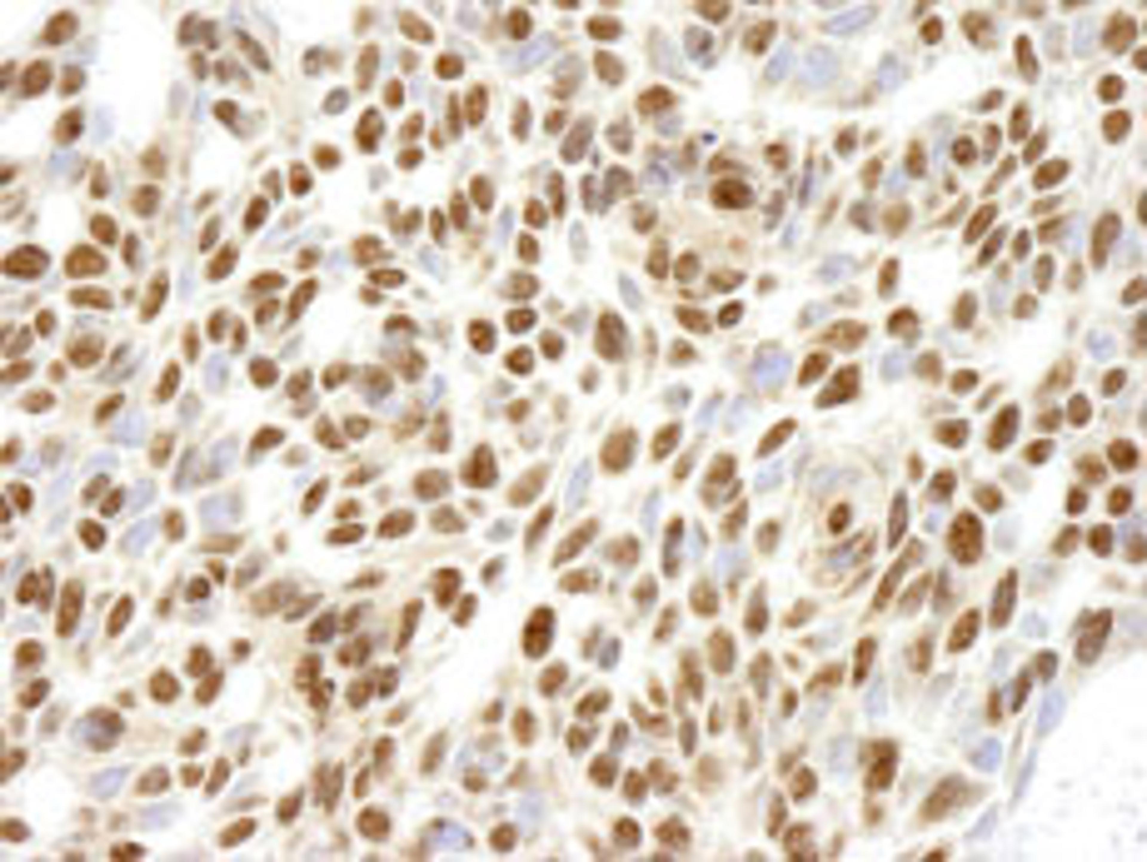 Detection of human RPL26 by immunohistochemistry.