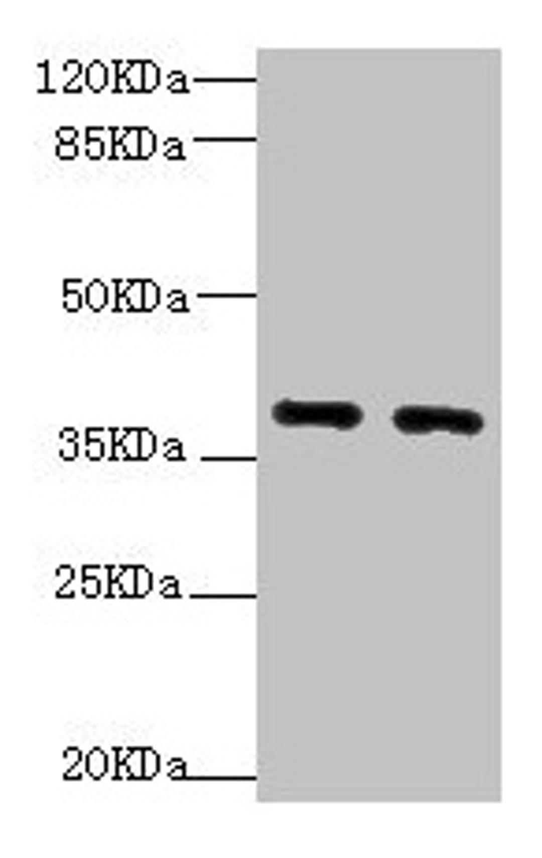 Western blot. All lanes: QKI antibody at 1.92µg/ml. Lane 1: HL60 whole cell lysate. Lane 2: K562 whole cell lysate. Secondary. Goat polyclonal to rabbit IgG at 1/10000 dilution. Predicted band size: 38, 37, 36 kDa. Observed band size: 38, 70 kDa