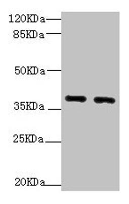 Western blot. All lanes: QKI antibody at 1.92µg/ml. Lane 1: HL60 whole cell lysate. Lane 2: K562 whole cell lysate. Secondary. Goat polyclonal to rabbit IgG at 1/10000 dilution. Predicted band size: 38, 37, 36 kDa. Observed band size: 38, 70 kDa
